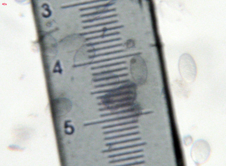 Su bruciato (cfr. Pyronema sp.)